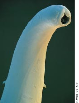 Hookworm Infection-01.jpg