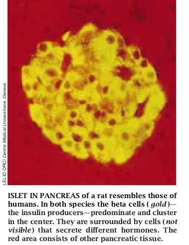 Treating Diabetes with Transplanted Cells-04.jpg