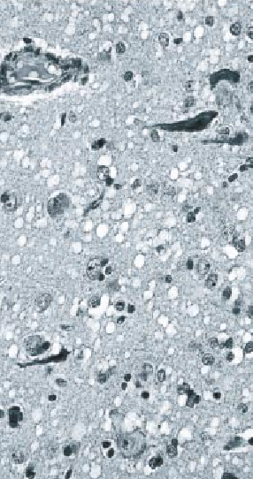The Prion Diseases-08.jpg