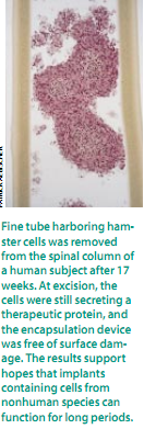 用于治疗的胶囊包裹细胞 6.png