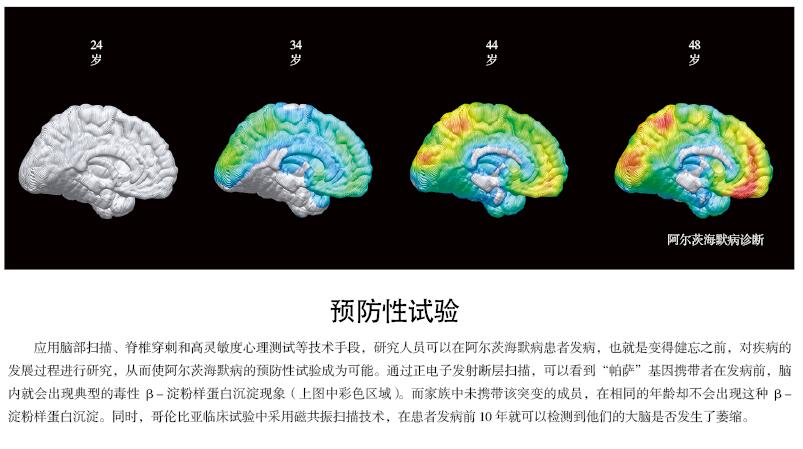 哥伦比亚的26个阿尔茨海默病家族.jpg