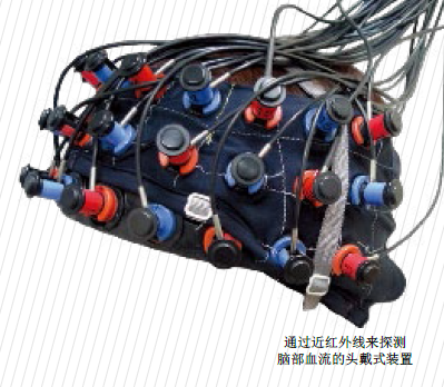 红外线能诊断精神疾病吗1.png