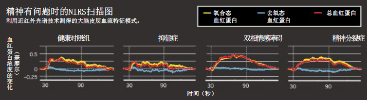 红外线能诊断精神疾病吗.png