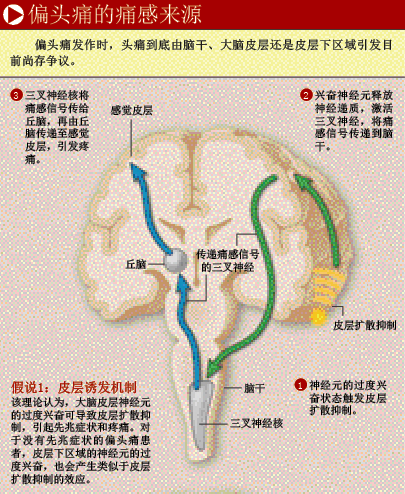 驱逐偏头痛 (2).png