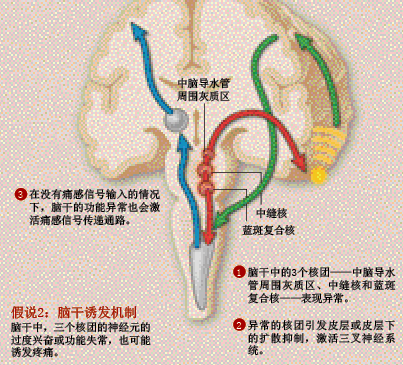 驱逐偏头痛 (3).png