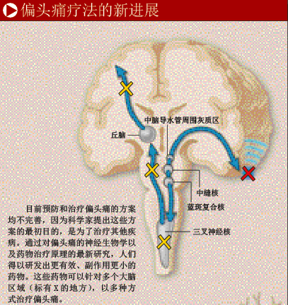 驱逐偏头痛 (4).png