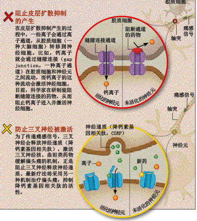 驱逐偏头痛 (5).png