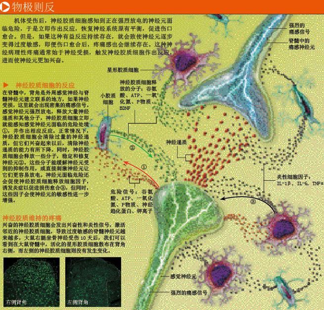 慢性痛生命不能承受之重 (2).png