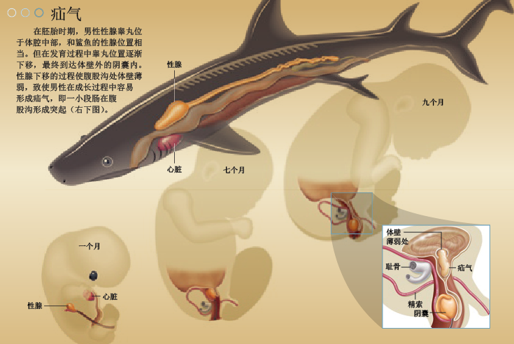 打嗝来自两栖类祖先的进化缺陷 (2).png