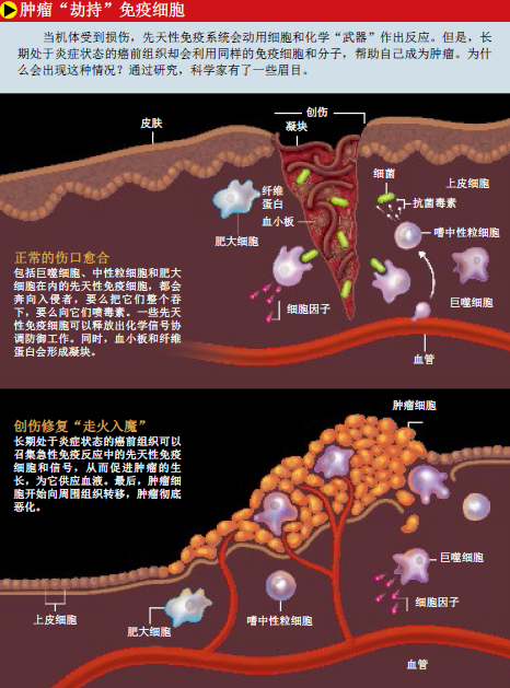 免疫系统竟是癌症帮凶 (1).png