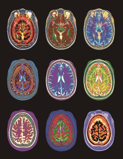 skeptical of brain scans-1 1.jpg