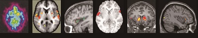 skeptical of brain scans-4 4.jpg
