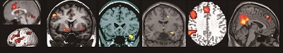 skeptical of brain scans-6 6.jpg