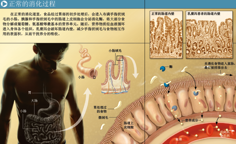 面食引发的致命腹泻 (2).png