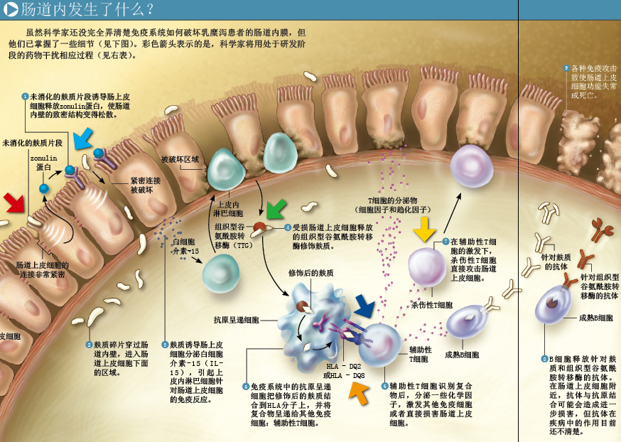 面食引发的致命腹泻 (4).png