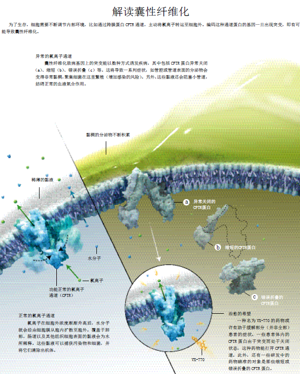 囊性纤维有望根治.png