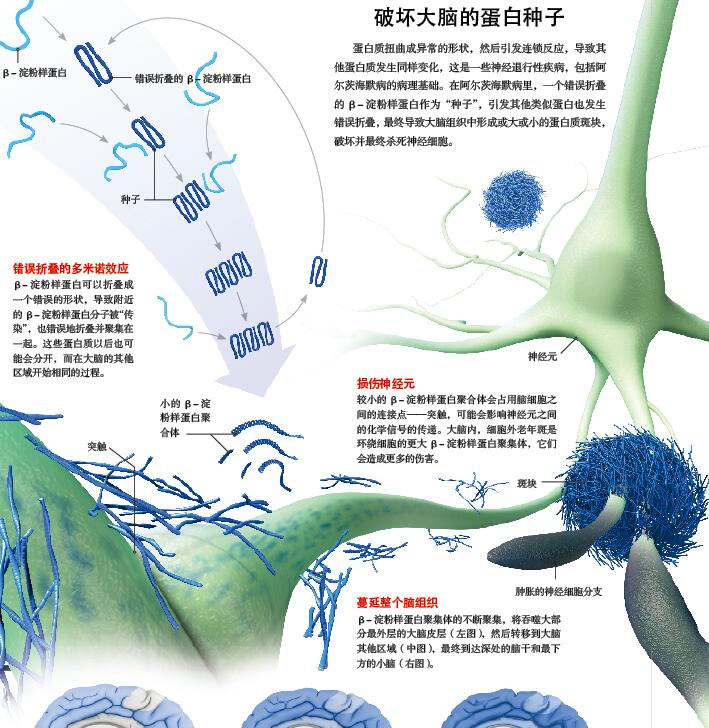挖出老年痴呆的种子.jpg