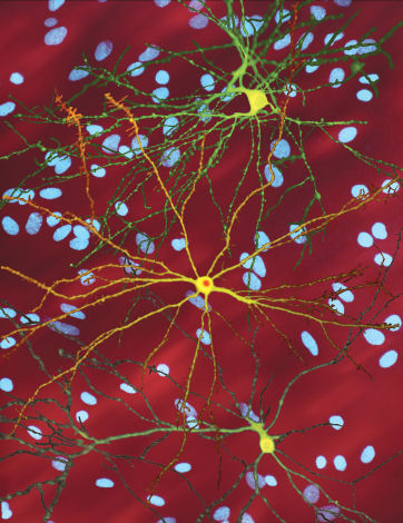 Neuron_with_mHtt_inclusion.jpg