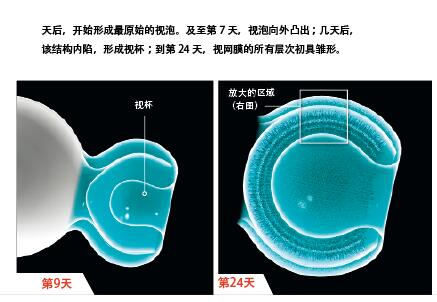 培养皿长出视网膜1.jpg