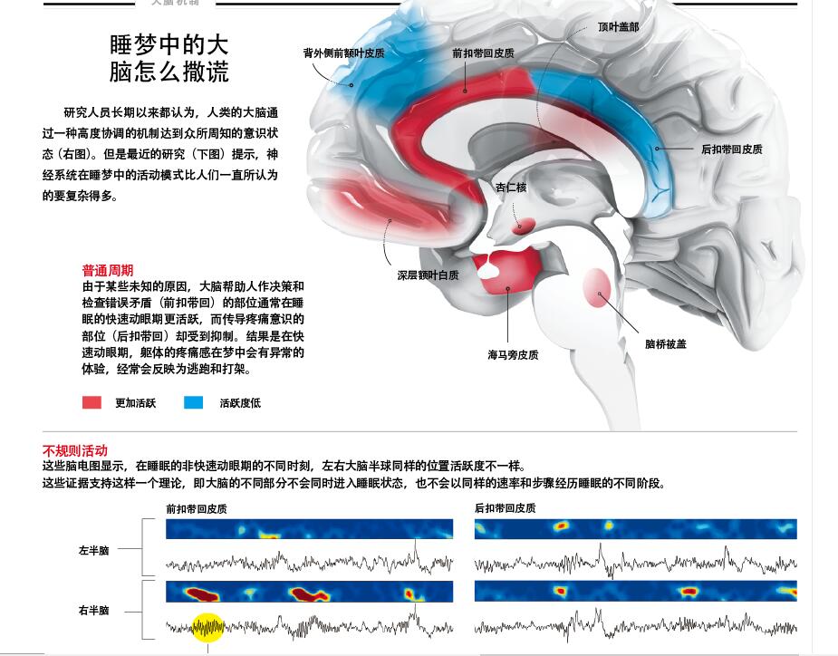 梦游症背后的意识难题.jpg