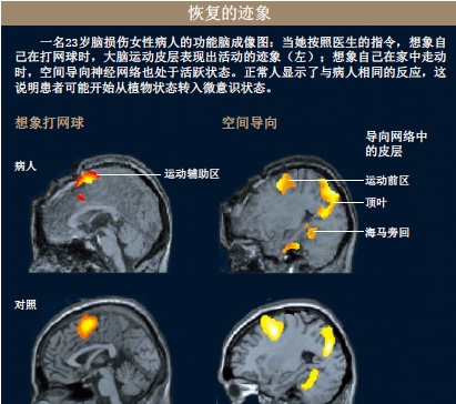 唤醒植物人 (2).png
