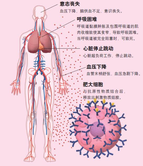 120530_过敏-4 图.jpg