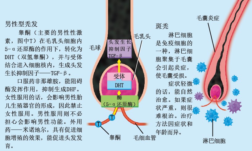 20130466为什么脱发_f2.jpg