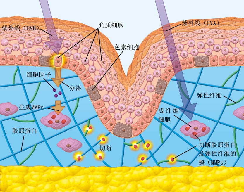20130572皱纹_f2.jpg