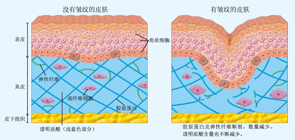 20130572皱纹_f1.jpg