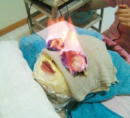 20130582骇人的火疗.jpg