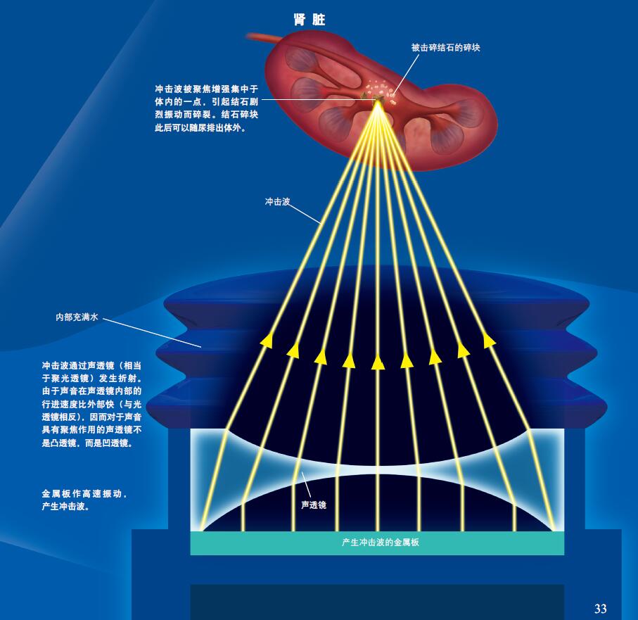 201107p30_f2.jpg