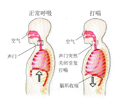 20131290为什么憋气或受惊吓就能止嗝.jpg